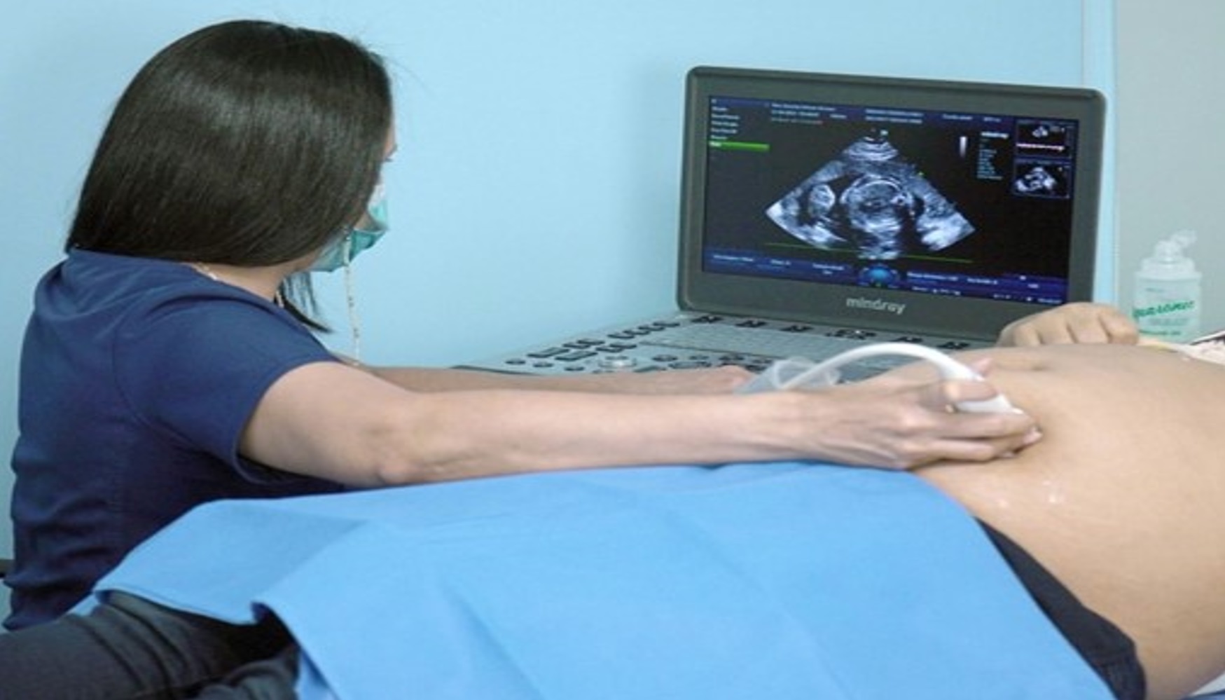 Unidad de Imágenes cardiovasculares: Ecocardiografia fetal
